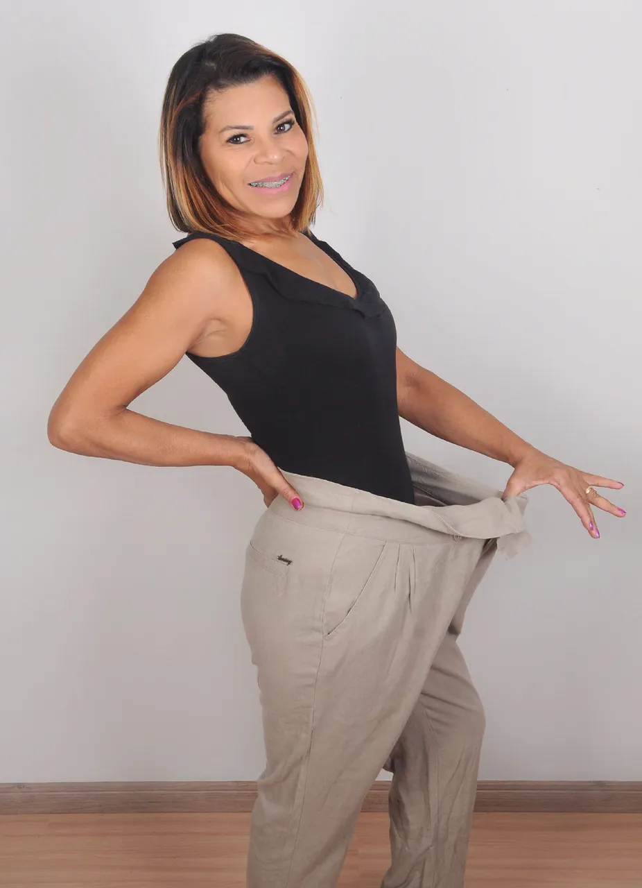 Foto depois do caso 2 de sleeve